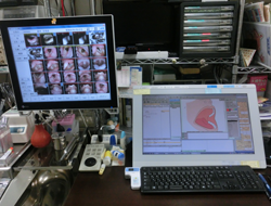 電子カルテとファイリングシステム